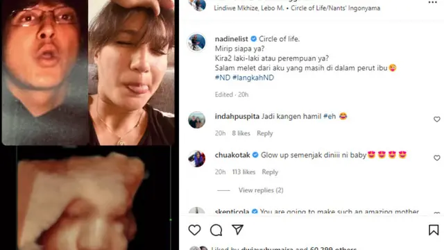 Nadine Chandrawinata dan Dimas Anggara