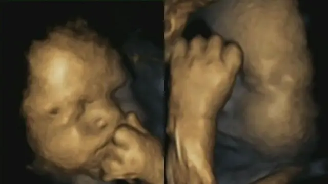 bayi dalam kandungan