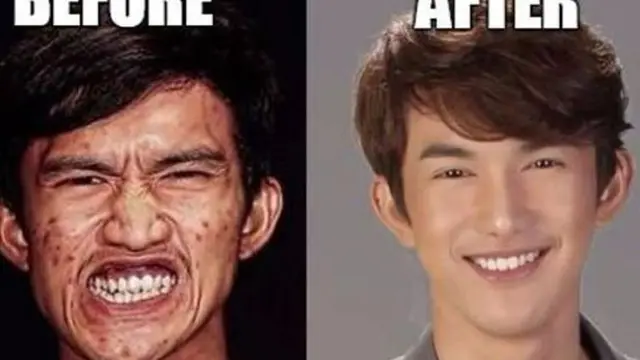 [Bintang] Foto Masa Lalu Pria Ini Bikin Banyak Orang Terkejut, Ternyata...