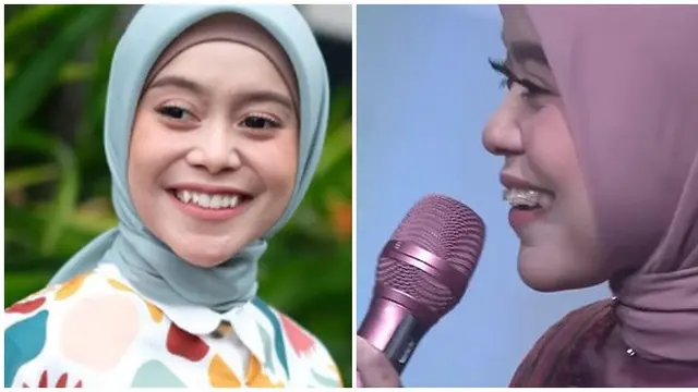 6 Beda Gaya Lesti Kejora Sebelum vs Sesudah Pakai Behel, Hilangkan Gingsul
