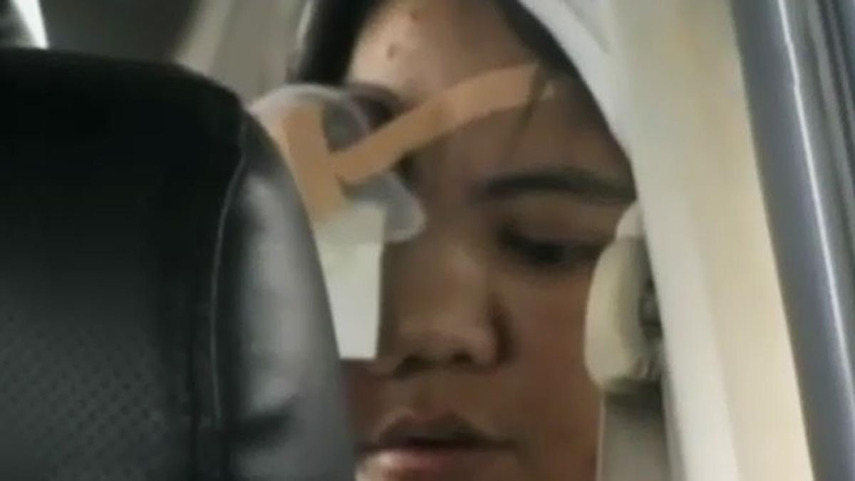 Pasien BPJS Tumor Mata Tak Kunjung Dioperasi di RSCM - News Liputan6.com