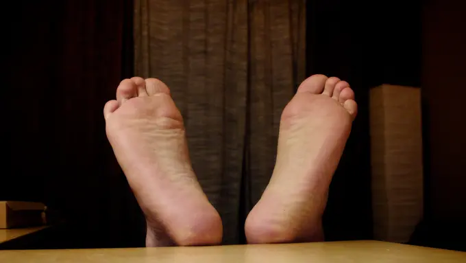 Dikira Varises, Ternyata Kaki Pria Ini Jadi Sarang Cacing!