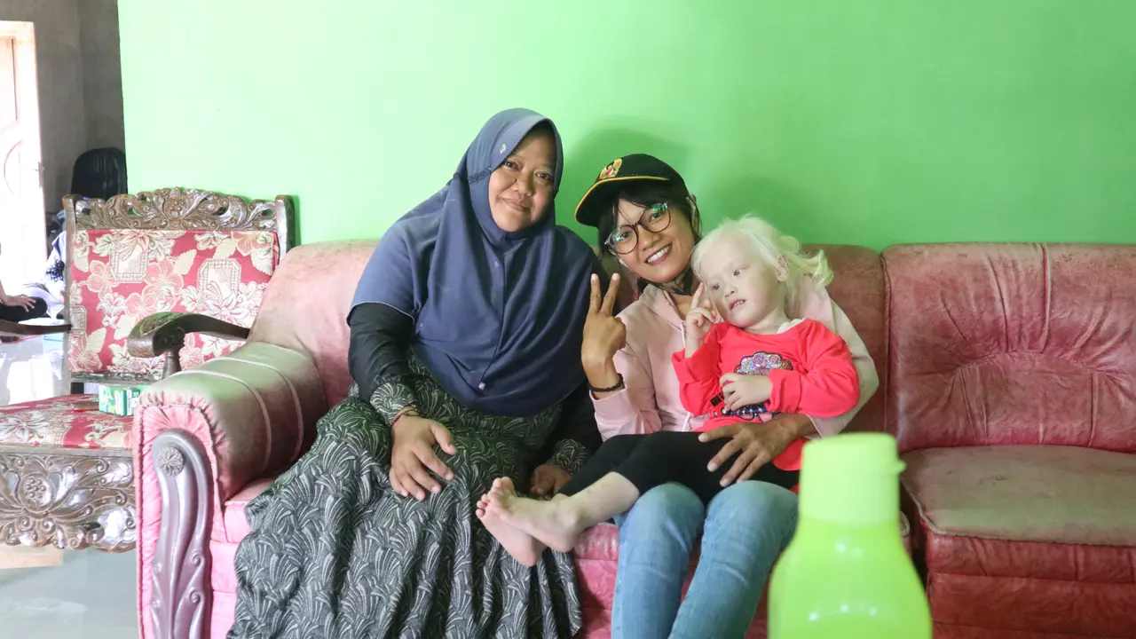 Kembar Albino di Wonogiri