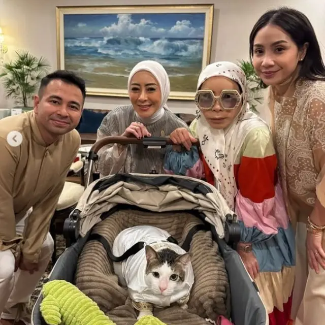 Pengakuan Melly Goeslaw wajahnya berubah karena oplas, bahagia bisa operasi bukan karena diendorse