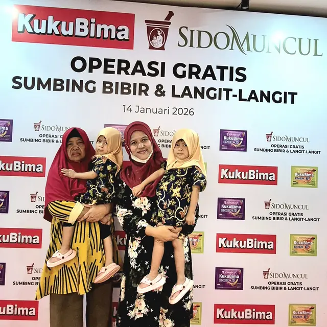 Sido Muncul Kembali Gelar Operasi Gratis Sumbing Bibir, Hadirkan Harapan Baru 50 Anak-Anak di Bogor