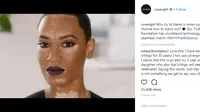 CoverGirl bekerja sama dengan model yang memiliki kelainan pigmentasi kulit (instagram/covergirl)