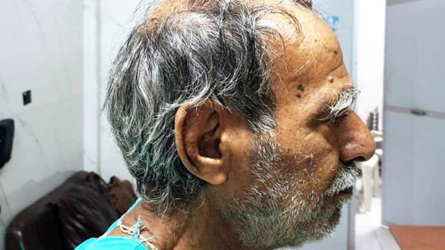 kakek di India miliki tanduk