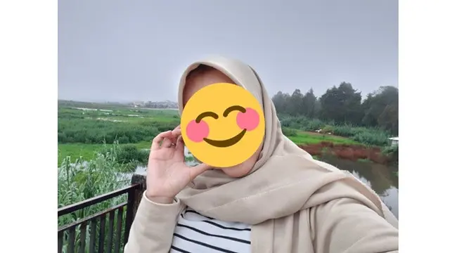 Wanita Ini Minta Jerawat Dihilangkan, 6 Hasil Editan Foto Bikin Senyum