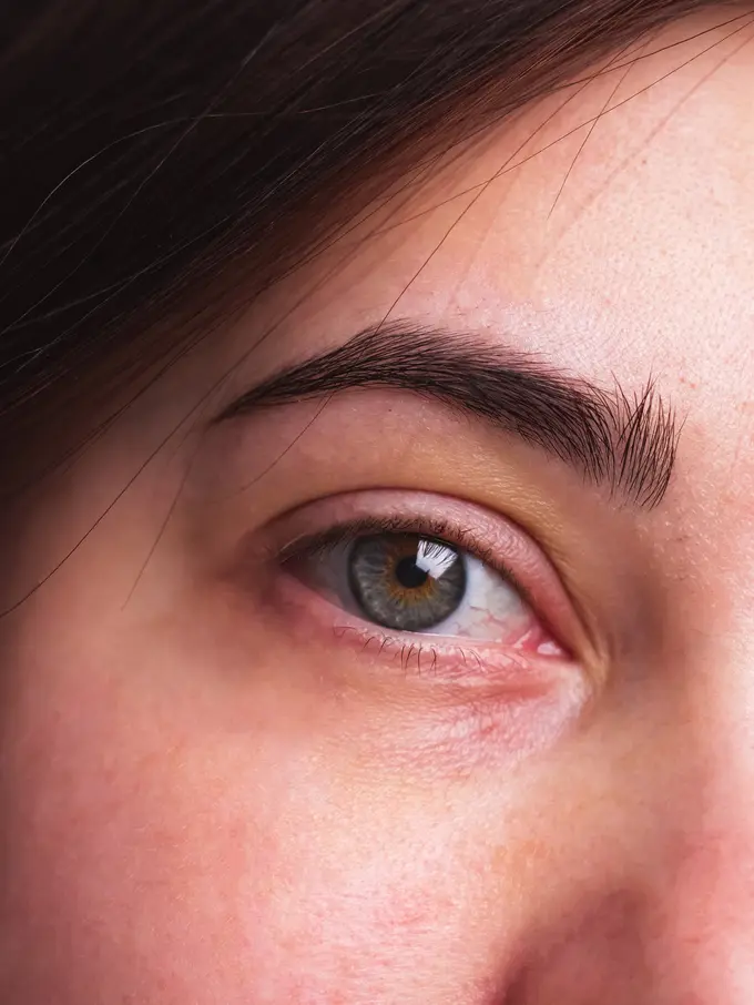 Faktor Penuaan Alami