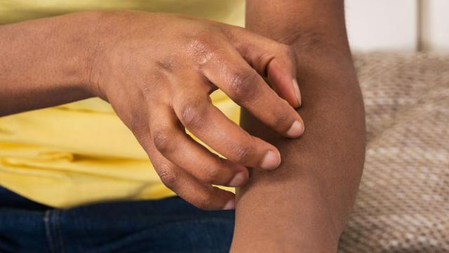 Perbedaan Rasa Gatal karena Diabetes dan Penyakit Kulit