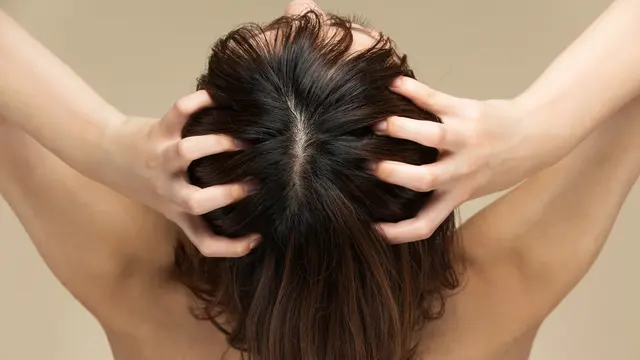 Eksfoliasi Kulit Kepala Ternyata Penting, Bagaimana Sih Cara Melakukannya?