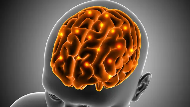 Ilustrasi otak manusia, mengidap empty sella syndrome