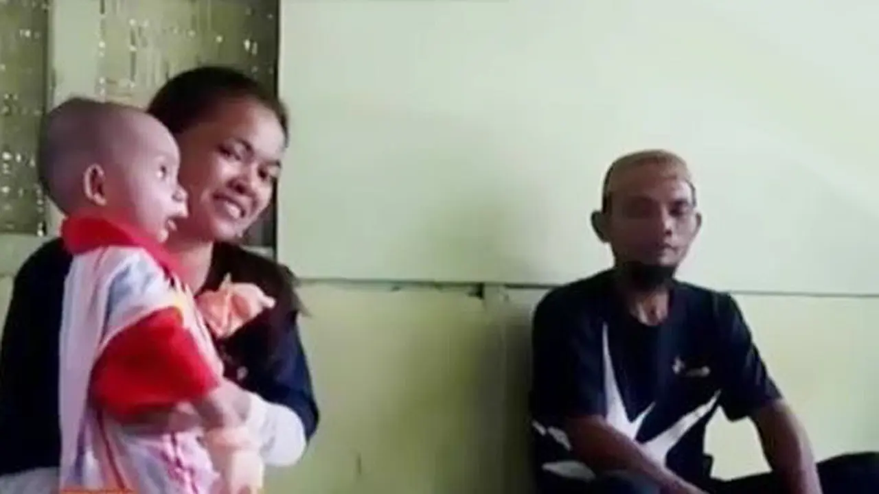 Pundi Amal Gelar Operasi Gratis