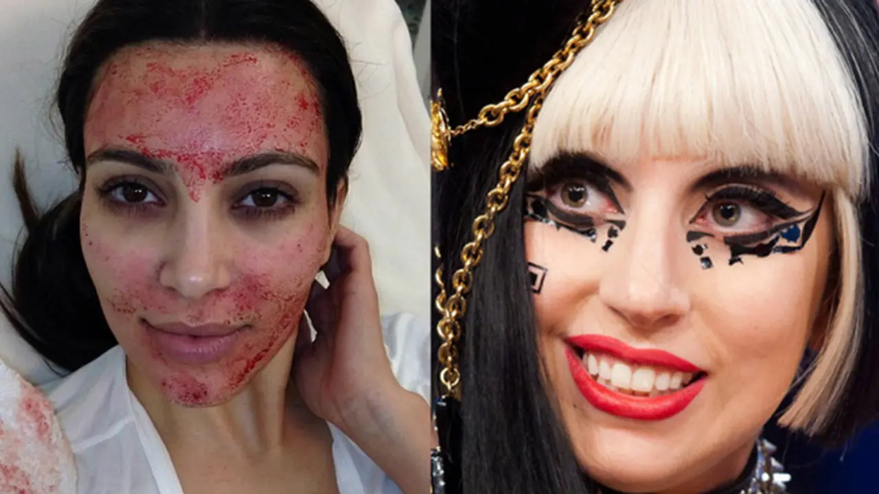 Ritual Kecantikan Aneh yang Dilakukan 7 Selebriti Hollywood