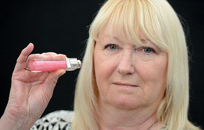Lynda memegang lipgloss Dior Addict yang mengandung pengawet penyebab alergi pada bibirnya | foto: copyright dailymail.co.uk