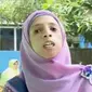 Lisa menderita penyakit TCS jenis penyakit langka. (Liputan 6 SCTV)