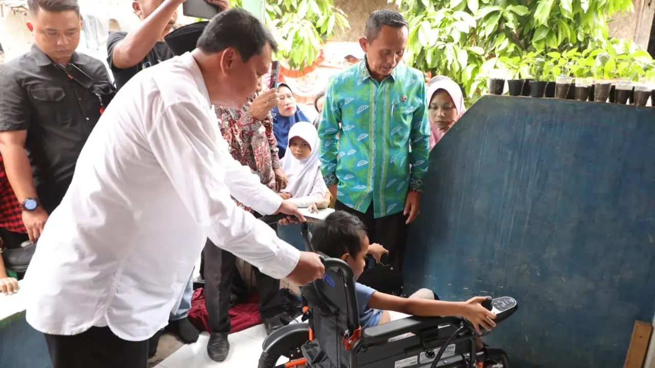 Bupati Tangerang Moch. Maesyal Rasyid mengunjungi seorang anak berusia 7 tahun berisinal FM yang menjadi korban kecelakaan hingga menyebabkan kakinya harus diamputasi.