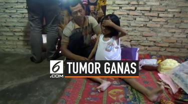 Seorang bocah 6 tahun di Bakauheni, Lampung menderita tumor ganas di perutnya. Orangtua tak bisa membawanya ke rumah sakit karena keterbatasan biaya dan tak punya BPJS.
