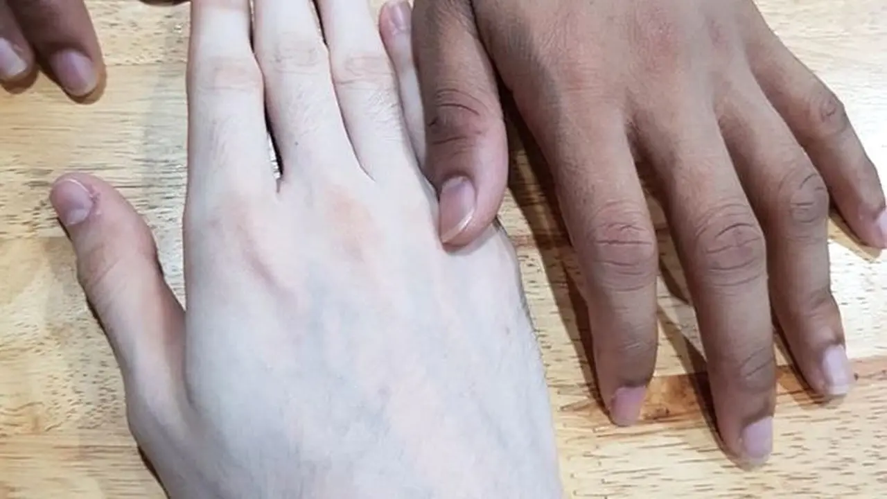 Hasil krim pemutih. (Sumber: odditycentral)