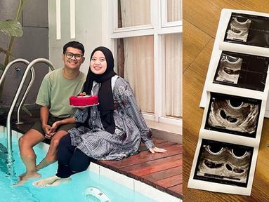 Musdalifah Basri membagikan sebuah foto berisi setangkai bunga, test pack dan hasil USG beserta pemeriksaan kehamilannya. Dalam caption unggahan tersebut, ia juga mengucapkan rasa syukurnya. "Alhamdulillah tahun 2023 diawali dengan kebahagiaan. Doain ya guys," tulisnya. (Liputan6.com/IG/@musdalifahbasri)