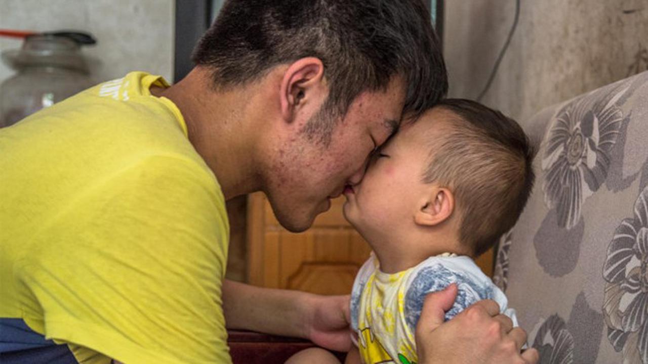 Ingin Selamatkan Adik yang Leukimia, Perjuangan Pria Ini Memilukan