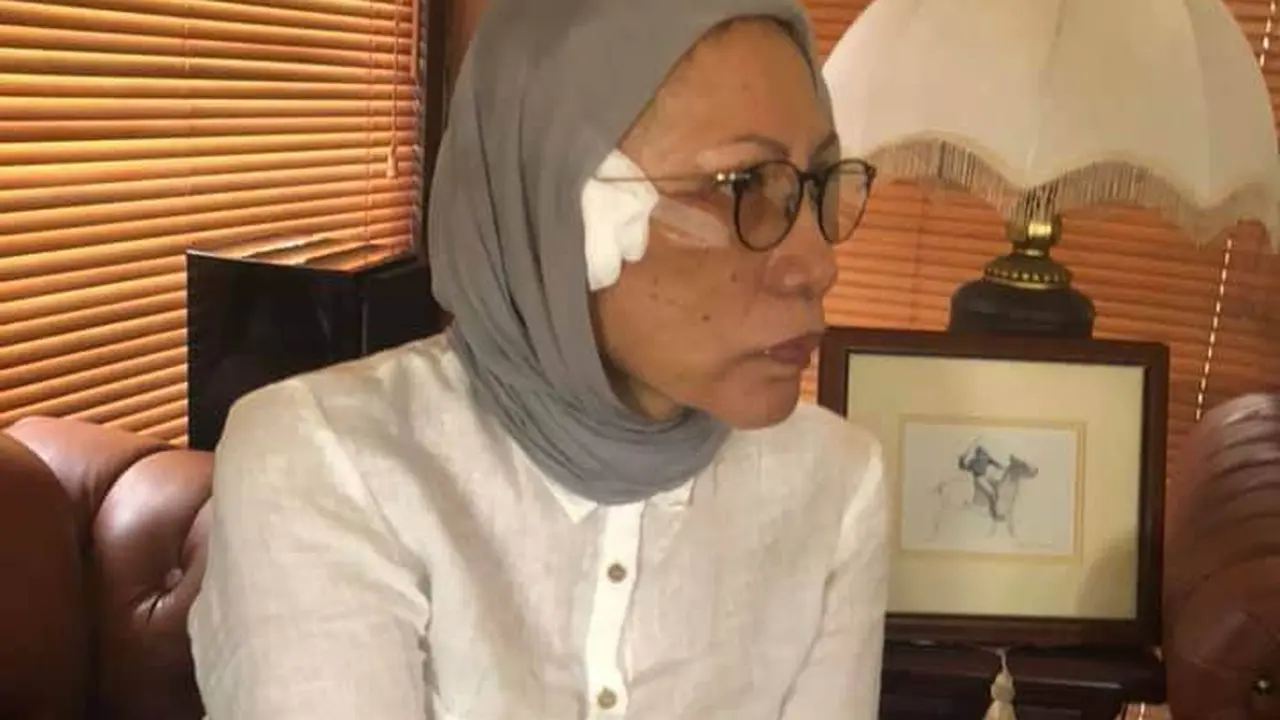 Beredar Foto Kain Kasa di Pelipis Ratna Sarumpaet. (Foto: Istimewa)