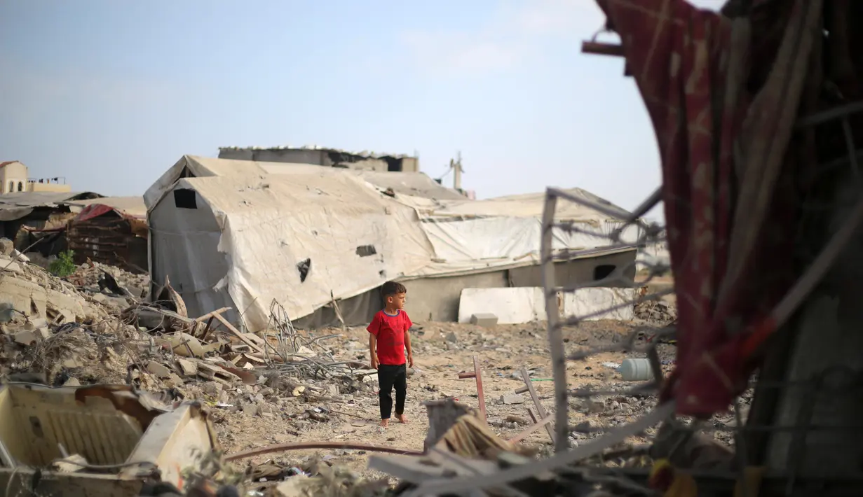 Perwakilan WHO di wilayah Palestina mencatat sanitasi yang buruk, akses layanan kesehatan yang terbatas, serta adanya gangguan pada program vaksinasi rutin jadi faktor penyebab kenaikan. (Eyad BABA/AFP)