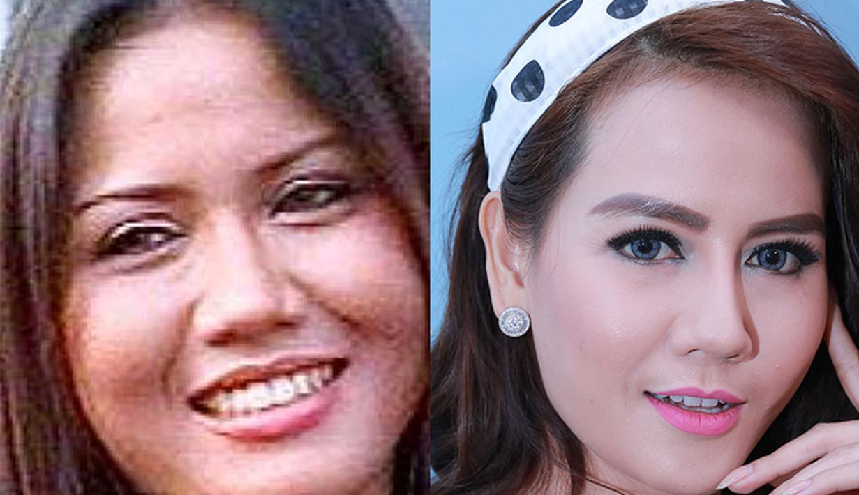 Operasi Plastik Ini Dia Nita Thalia Before After Photo Bintangcom