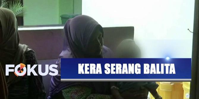 Kera Liar Masuk Rumah Warga Lalu Serang Seorang Balita