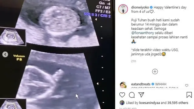 Dion Wiyoko mengabarkan kehamilan istrinya