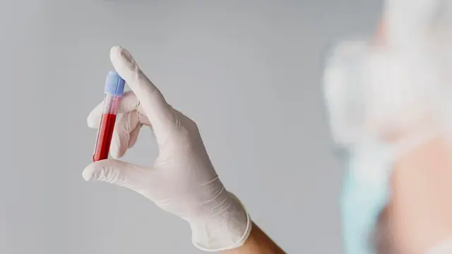 Anak membutuhkan zat besi sesuai kadar usianya