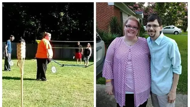 Berat Badan Tak Kunjung Turun, Ternyata Mengidap Kista Seberat 22 Kg