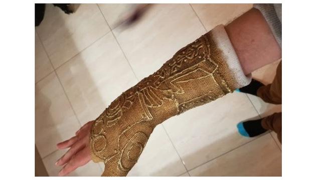 Pergelangan Tangannya Cedera, Pria Ini Gunakan Hiasan Gips yang Unik