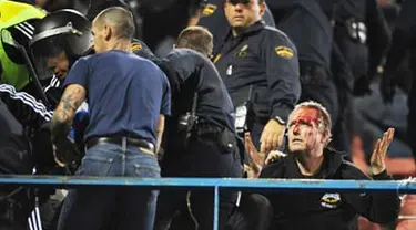 An injured Marseille supporter holds up his hands after clashing with riot police prior to the start of a Champions League football match against Atletico de Madrid at the Vicente Calderon stadium in Madrid on October 01, 2008. AFP PHOTO/PHILIPPE DESMAZES