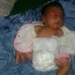 Bayi Jihan Novitasari hingga kini masih menunggu jadwal operasi yang entah kapan dilakukan tim medis RSUP dr Kariadi. (foto: Liputan6.com / edhie prayitno ige)