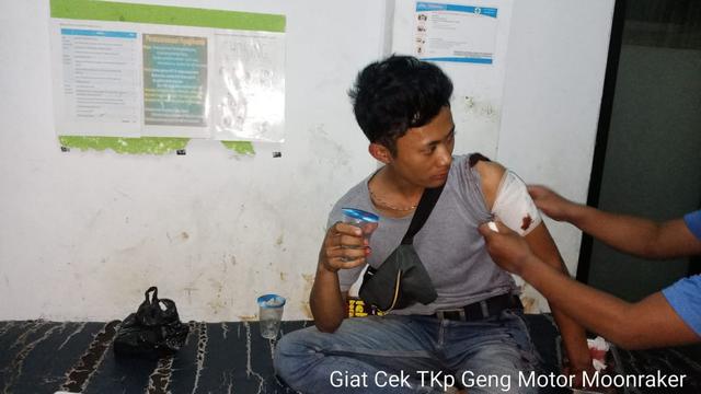 Salah seorang korban keberutalan anggota geng motor di jalan raya Bayongbong, Garut malam tadi