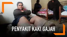 Seorang pria mengalami penyakit langka Elephantiasis atau Kaki Gajah. Kondisi ini membuatnya tak dapat beraktivitas.