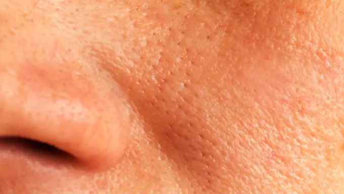 3 Bahan Alami Ampuh yang Mampu Kecilkan Pori-pori Wajah