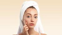How to Get Rid of a Pimple Fast: 9 Home Remedies for Acne