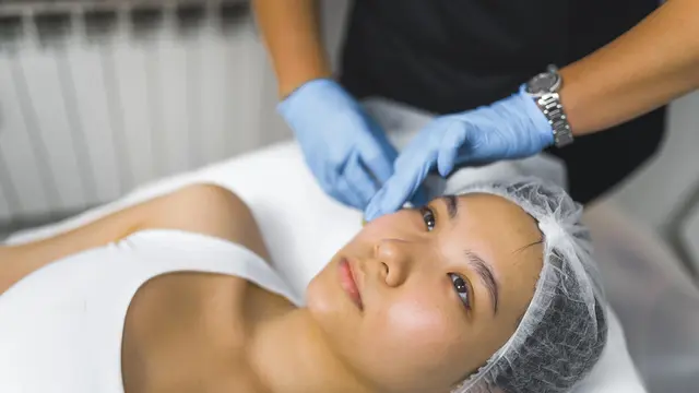 Rahasia Wajah Fresh tanpa Filter, Yuk Kenalan dengan Radiesse Treatment!