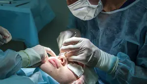 Ilustrasi operasi plastik. (dok. Olga Guryanova/Unsplash.com)