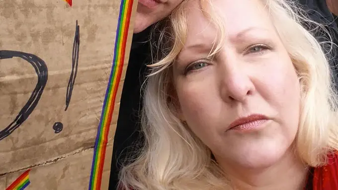 Lukai Penis Pasangan, Vagina Perempuan Ini Punya Gigi Tajam