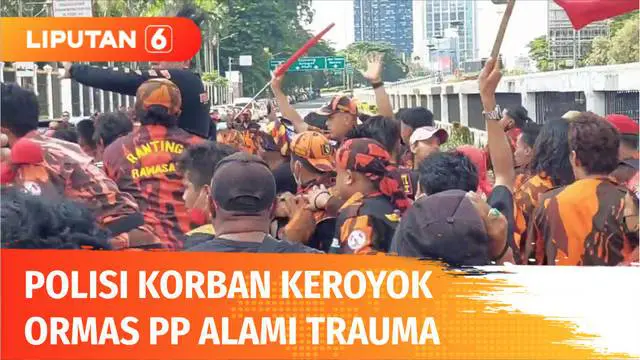 Polisi korban pengeroyokan massa ormas di depan Gedung DPR masih dirawat di Rumah Sakit Polri Kramatjati, Jakarta. Hasil observasi dan CT scan menunjukkan korban mengalami trauma pada bagian kepala.