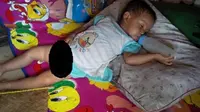 Bayi Arnah yang diduga sempat memakan ular itu pernah dibawa ke rumah sakit karena keracunan. Tapi, pengobatannya kini masih berlanjut. (Liputan6.com/Yandhi Deslatama)