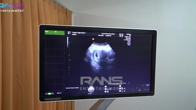 Hamil Anak Kedua, Ini 6 Momen Nagita Slavina dan Raffi Ahmad Cek USG Pertama Kali