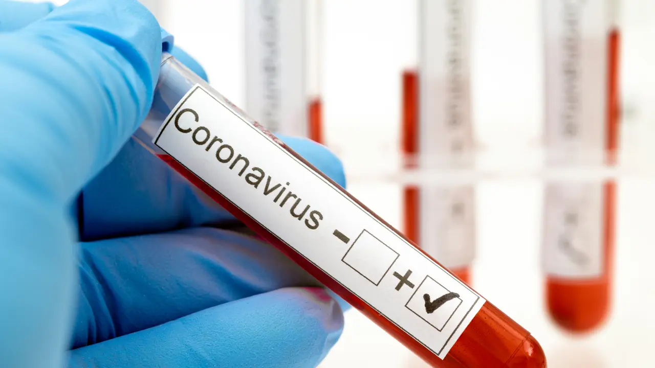 virus corona covid-19