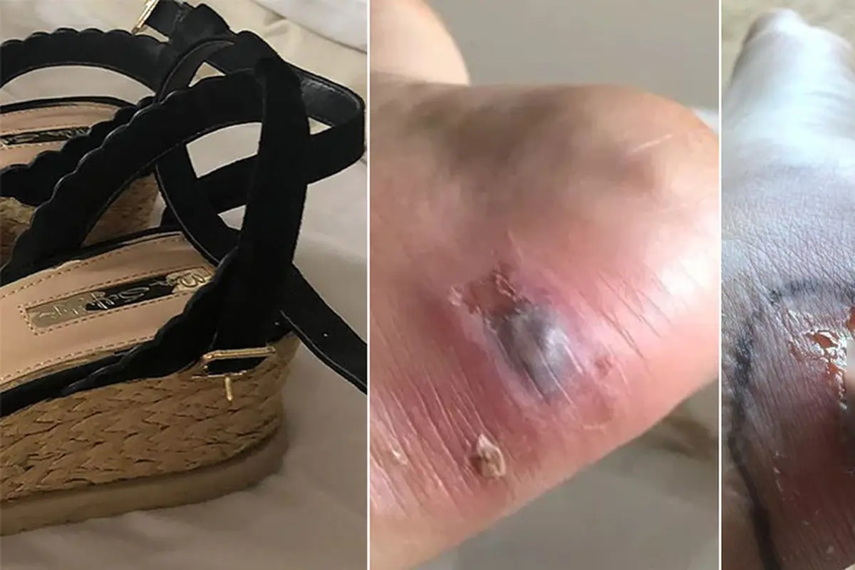 hampir meninggal karena heels