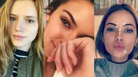 Lihat 10 Selebritas Dunia yang Juga Berjuang dengan Jerawat