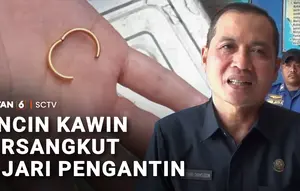 Cincin Kawin Tersangkut di Jari Pengantin