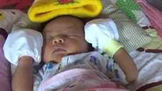 Seorang wanita yang memiliki kelamin ganda berhasil melahirkan anak pertamanya.
